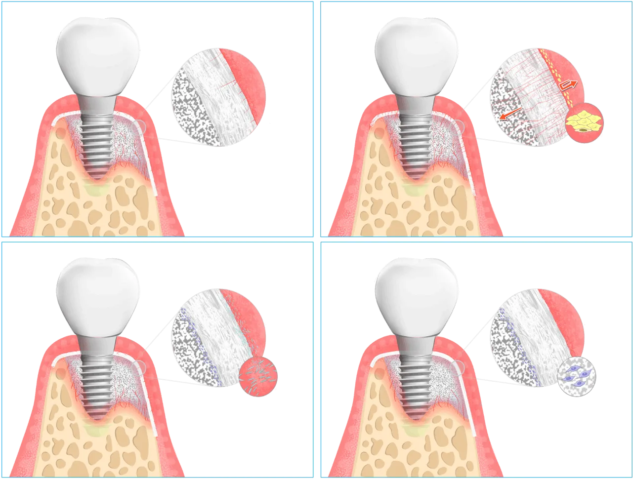 BellaOss™ membrane product view 1
